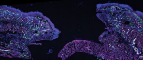 Micrografie van weefselmonsters met kleurrijke markeringen van cellulaire structuren in paars, groen en blauw.